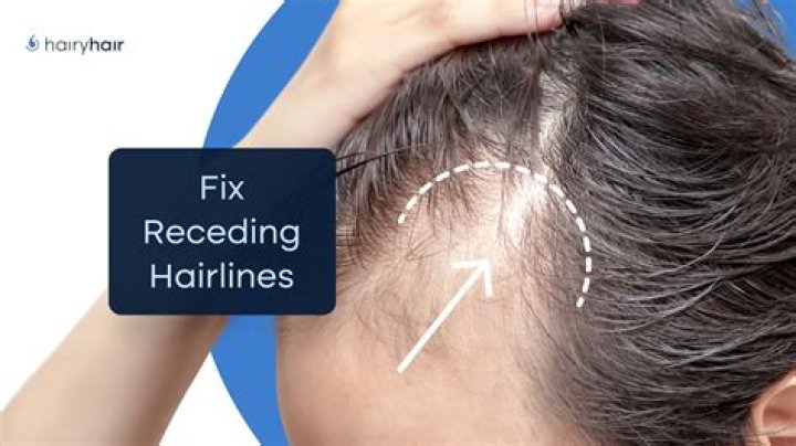 Shoppers With “Receding” Hairlines Saw Growth Thanks to This Shampoo