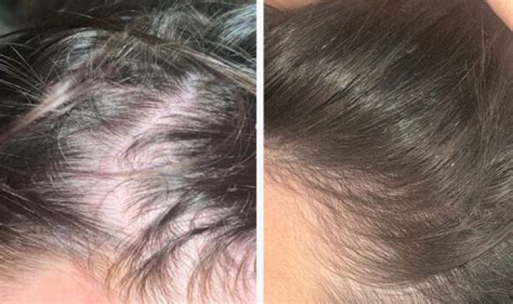 Shoppers With Thinning Hair Have “Locks Like Rapunzel” With This Shampoo