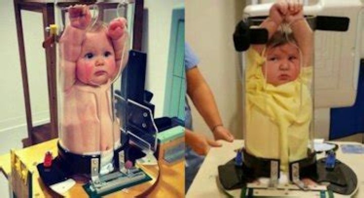 Stop Laughing At Babies Getting X-Rays — Fatherly