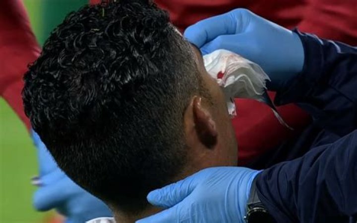 The blow that gave Cristiano Ronaldo a bloody nose
