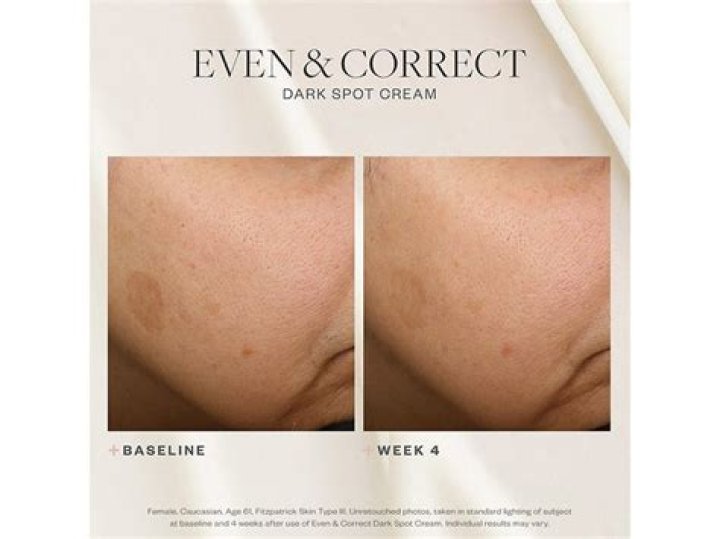 The SkinMedica Even and Correct Product Line Is Erasing My Dark Spots