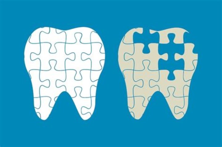 The White Teeth Puzzle