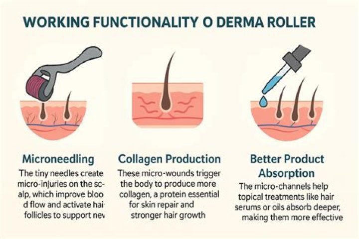 This Is Why You Should Use a Dermaroller On Your Scalp for Hair Growth