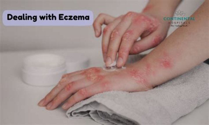 Tia Mowry Shares Her Experience Dealing With Eczema