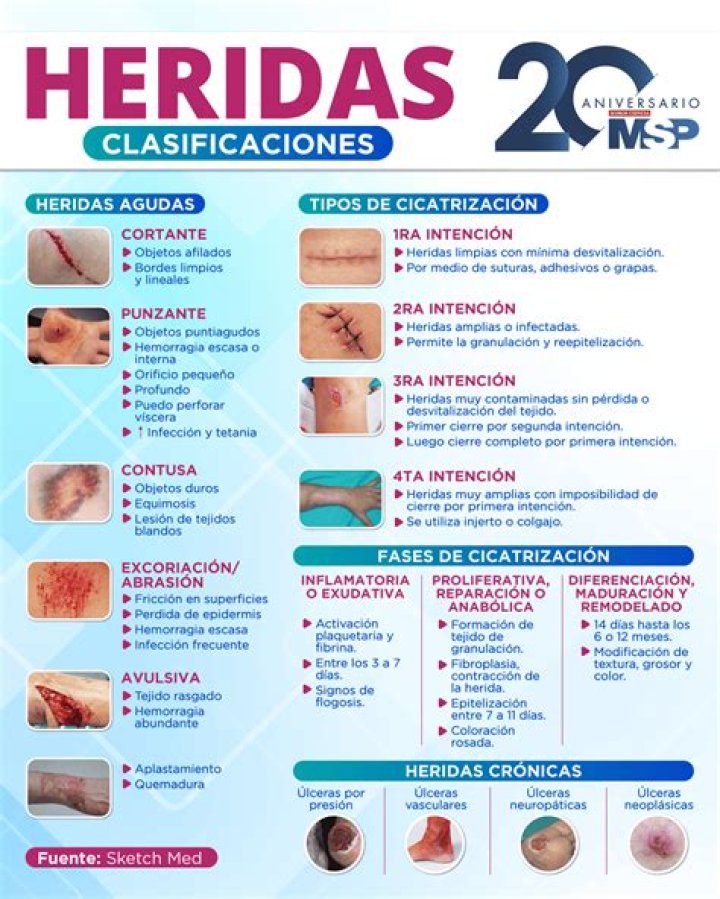 tipos y cuándo y cómo tratarlas