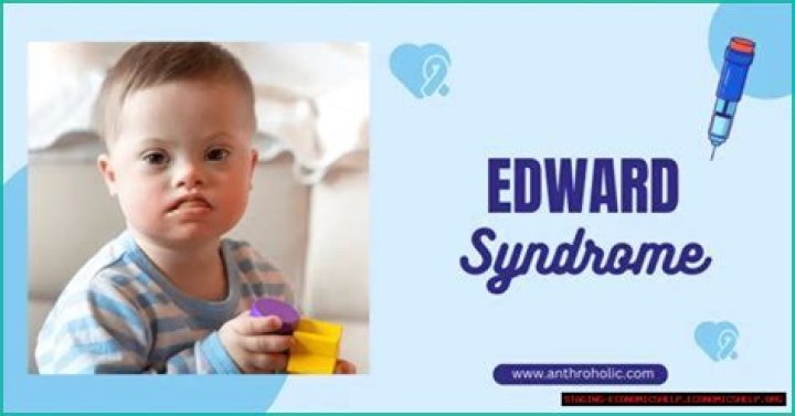 Understanding Edward Bluemel Disease: Causes, Symptoms, And Treatments