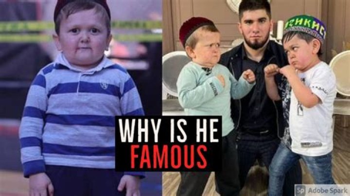Understanding Hasbulla: What Disorder Does He Have?