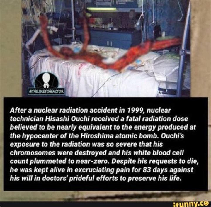 Understanding Hisashi Ouchi: The Tragic Story Behind The Infamous Nuclear Accident