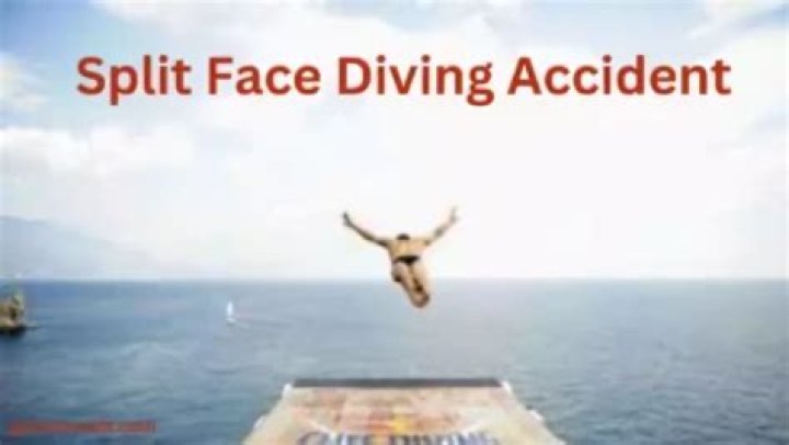 Understanding The Split Face Dive Incident Of 2009