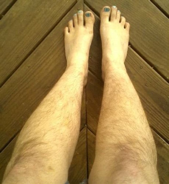 What do men think about women with hairy legs?