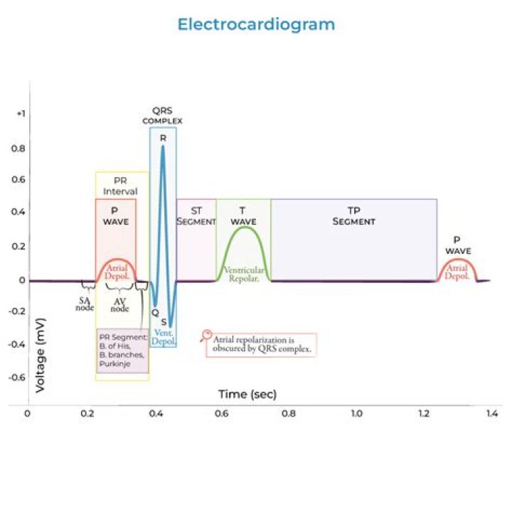 What do you do when an Electrogram is insufficient?