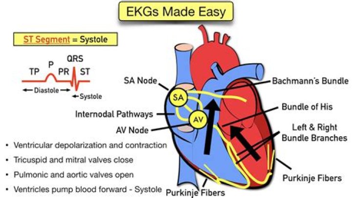 What does the ECG do in the Withings Move ECG?