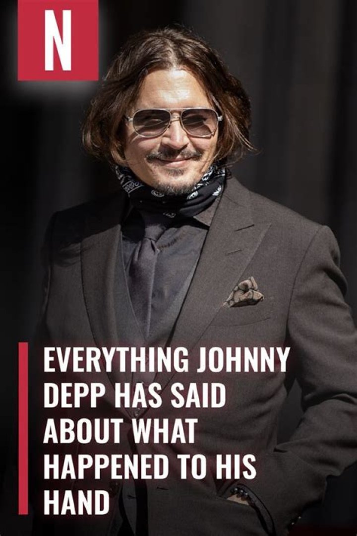 What Happened to His Hand?