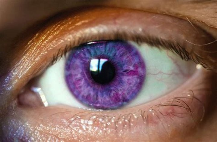 What is Alexandria’s Genesis? - All About Vision