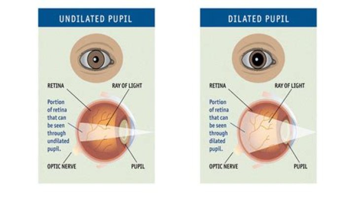 Why do eye doctors want to know what medications I'm taking?
