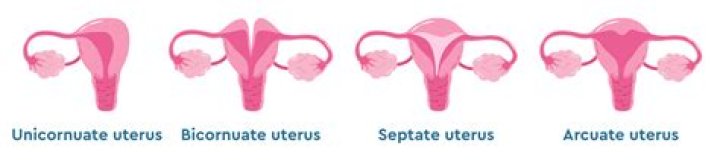 Why Shallow Vaginas or Shallow Uteruses Are a Myth
