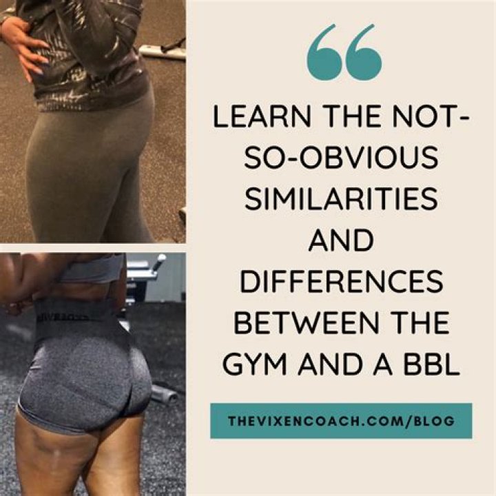Why This Woman's Butt Transformation Made People Online Hate Her