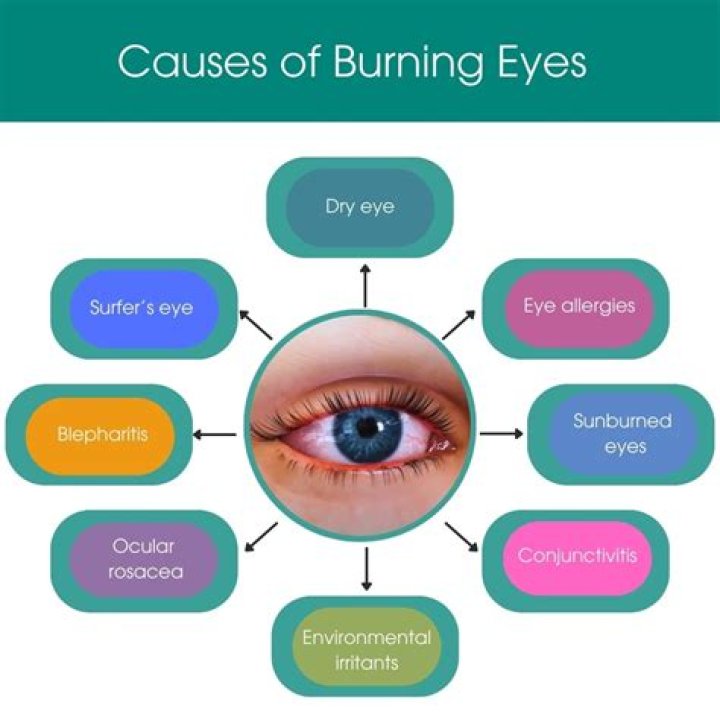 Why Your Eyes Burn or Sting